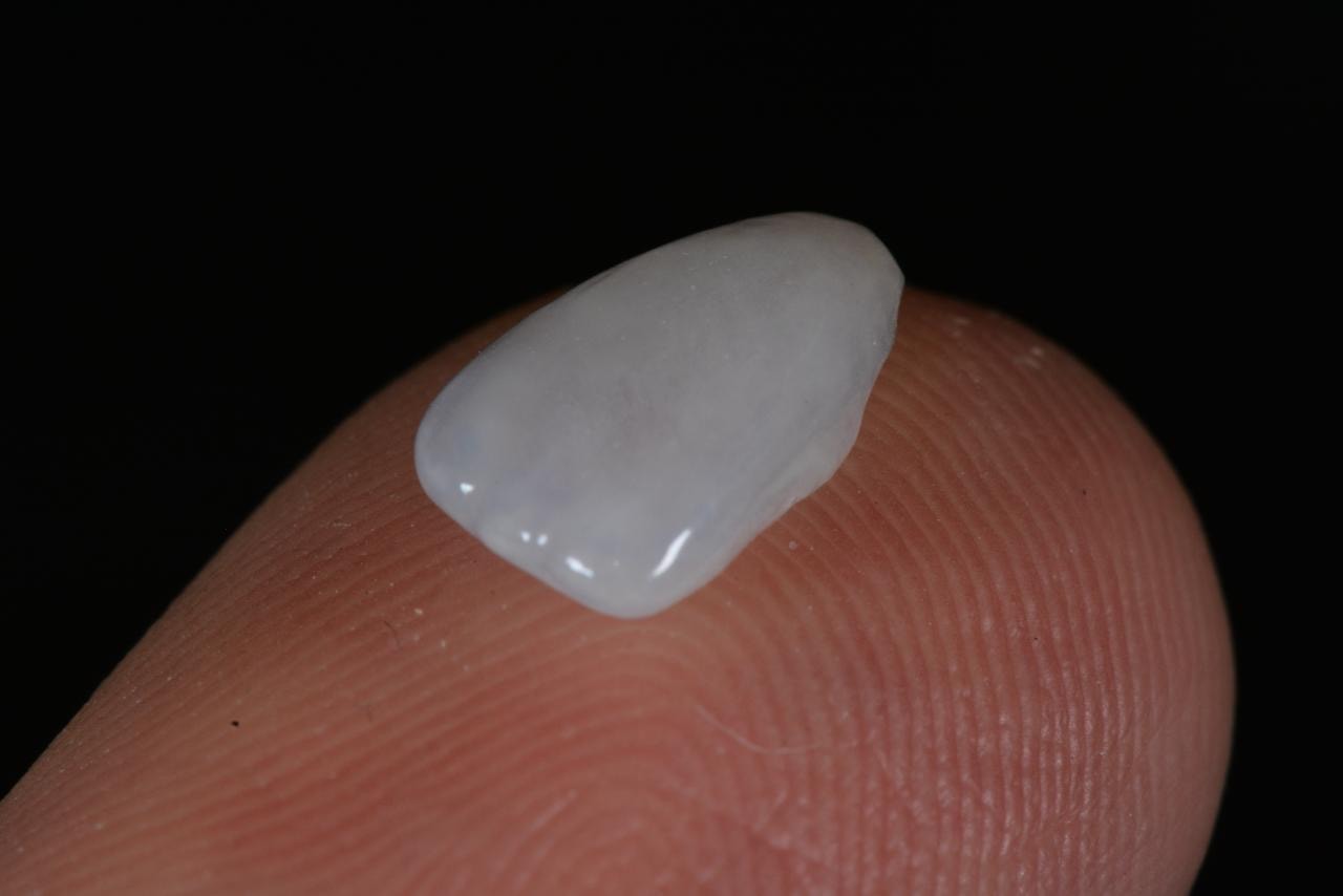 dettaglio faccette dentali