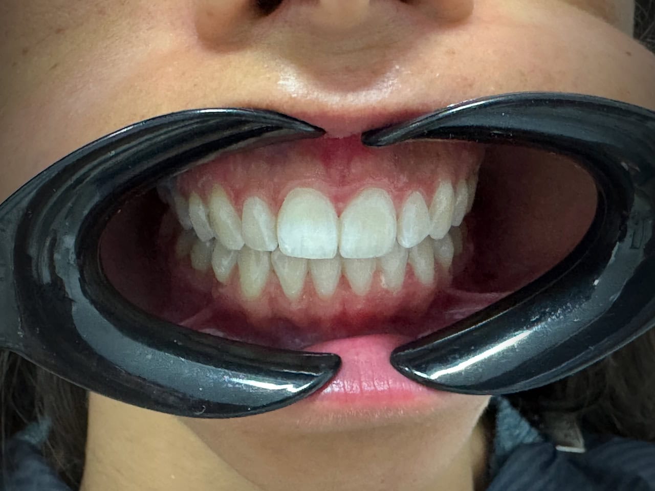 estetica dentale centro equipe dentale